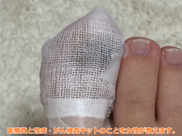 足爪剥がれる痛くない黒い内出血処置テープガーゼ6